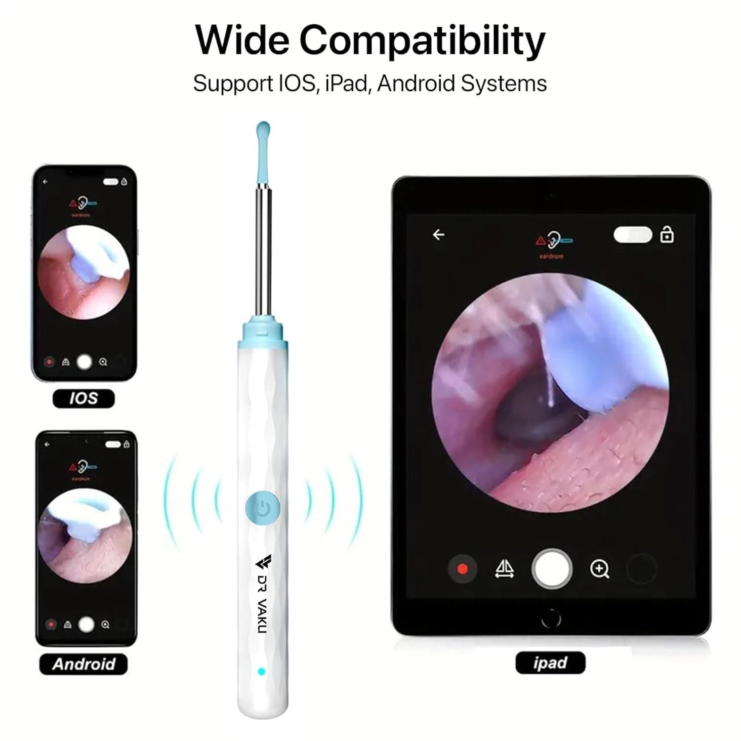🦻 Smart Visual Ear Wax Cleaner – See Before You Clean!